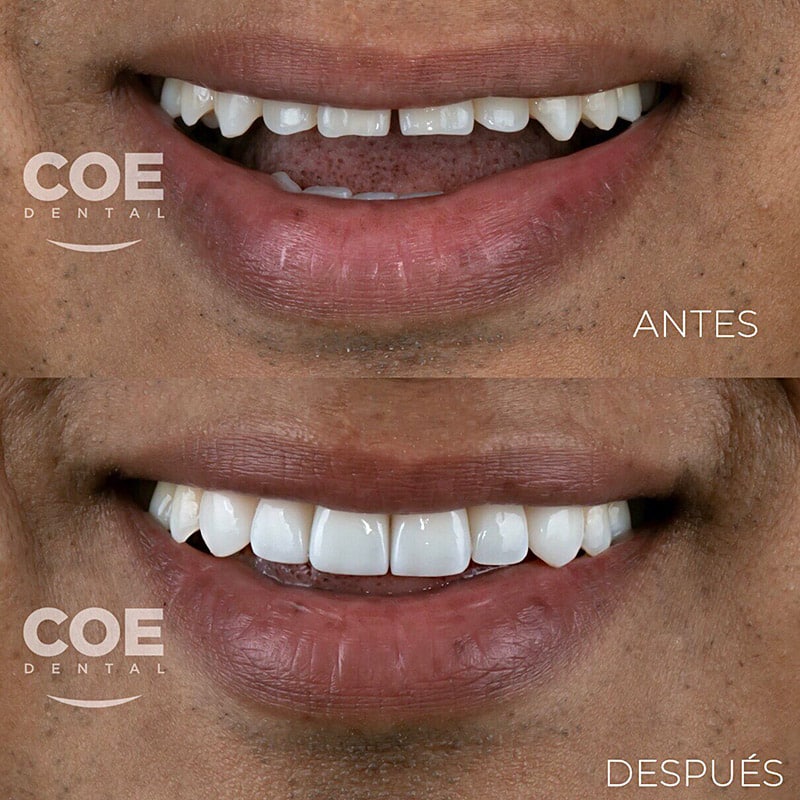 antes-despues-03