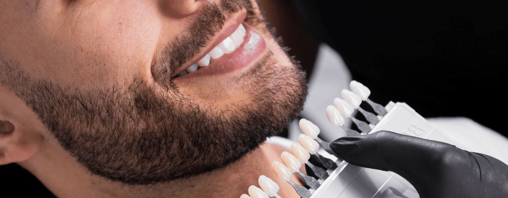 Paciente con carillas dentales perfectas.