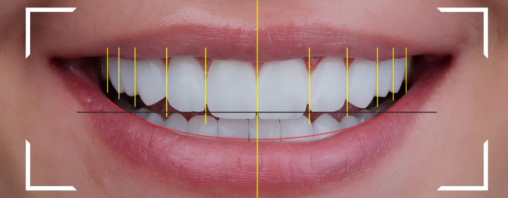 Descubre el diseño de sonrisa digital.