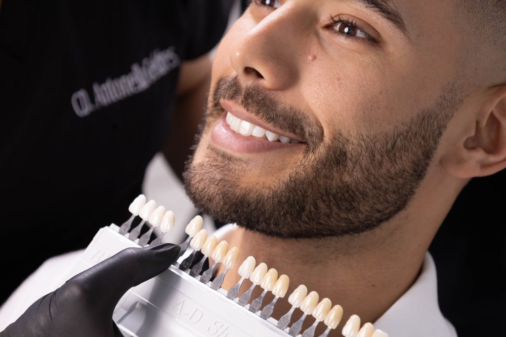 ventajas carillas dentales