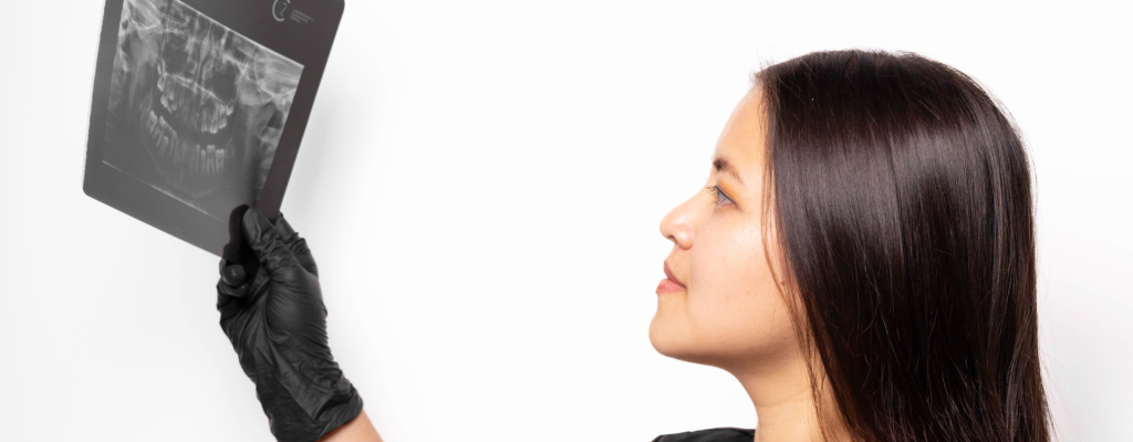 Aprende todo sobre los traumatismos dentales.