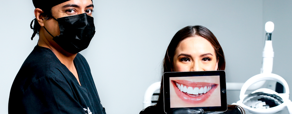 Conoce todo sobre la gingivoplastia.