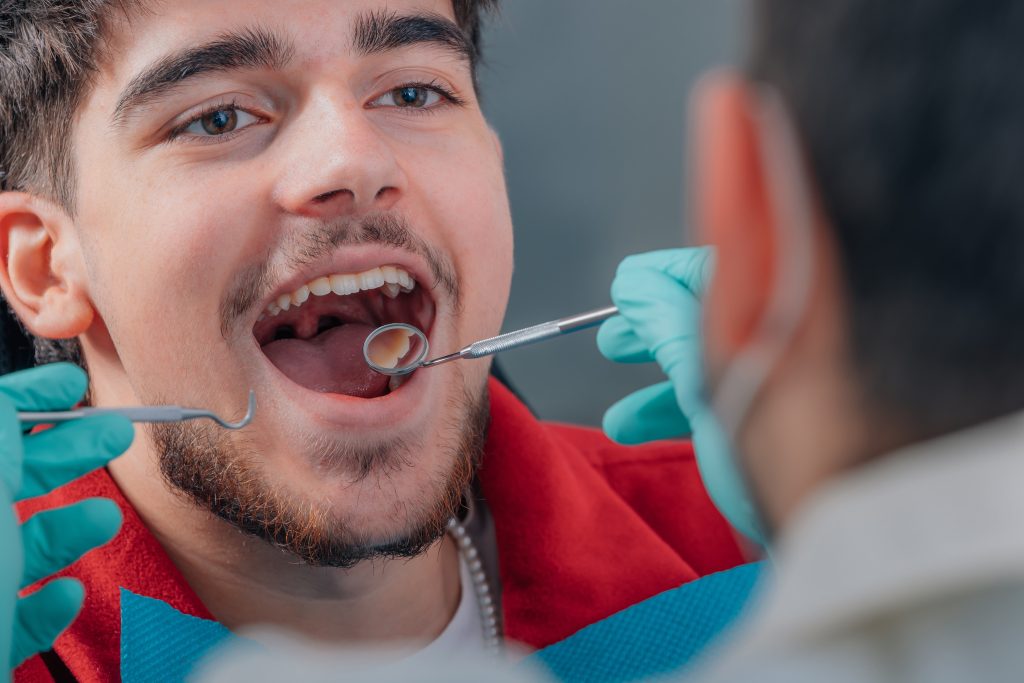 Sarro dental en hombre joven en el dentista