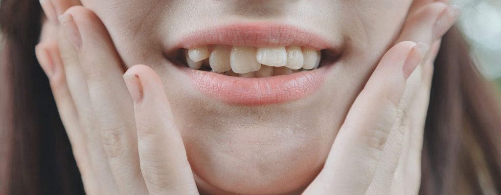 En este artículo, reflexionaremos sobre el problema de los dientes chuecos o apiñamiento dental que afecta a un gran porcentaje de personas.