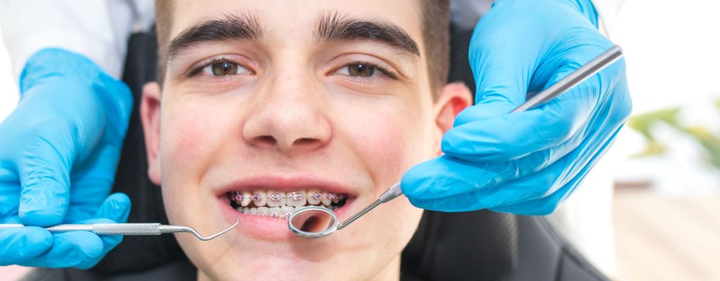 En este artículo conoceremos los tratamientos de ortodoncia y los tipos de tratamientos que existen.