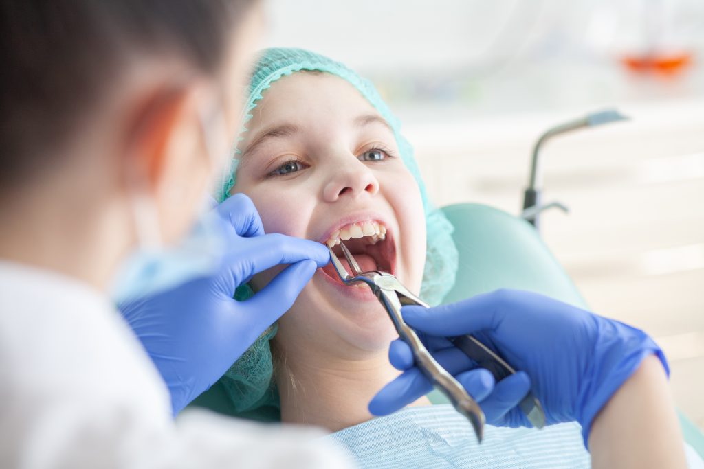 extracción de premolares