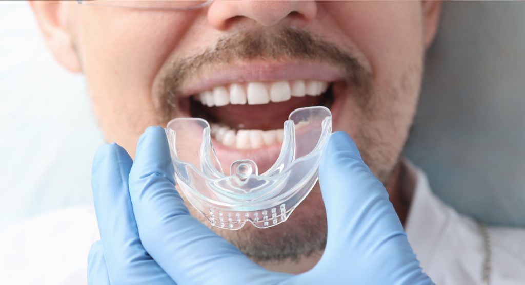 Férula dental: ¿Qué es y para qué sirve?