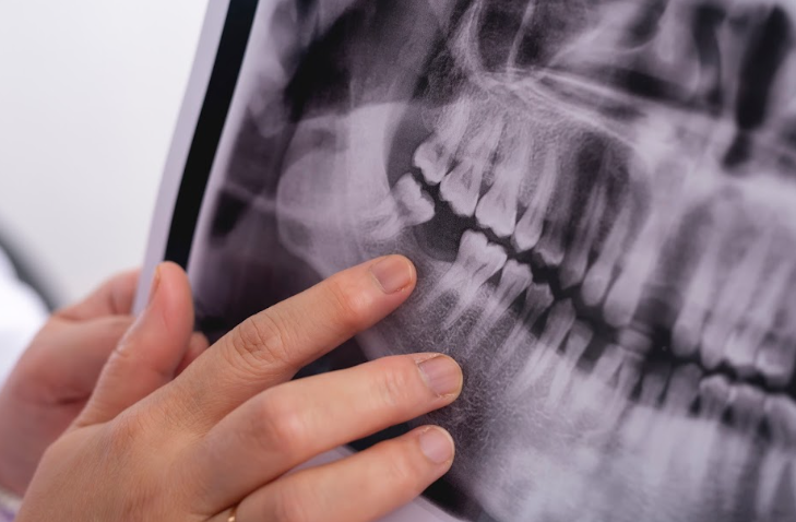 Tipos de radiografía dental