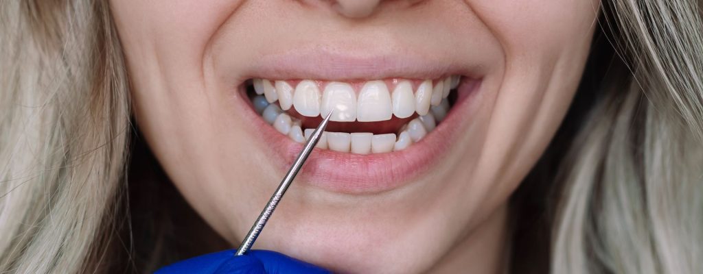 En este artículo aprenderemos qué es el esmalte dental, cómo funciona y qué factores pueden debilitarlo.